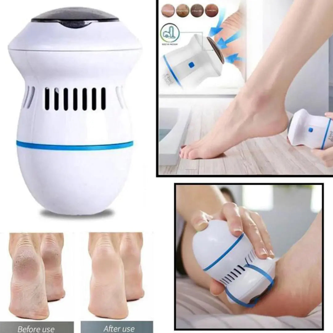 Cellus Foot Care Pedicure Tools Cellus Remover bareera bazaar